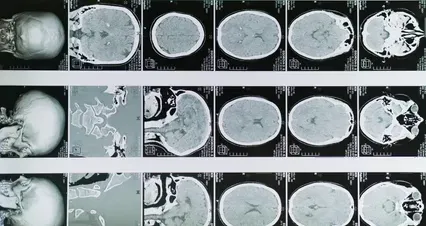 Horizontal video: Presenting x ray images 5724101. Duration: 25 seconds. Resolution: 4096x2160